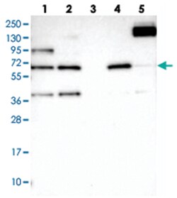 FAM13A1, Rabbit, Polyclonal Antibody, Abnova 100 &mu;L | Buy Online | Abnova Corporation | Fisher Scientific