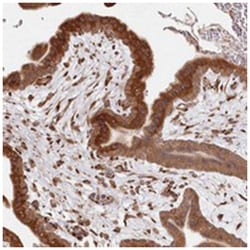 FAM13A1, Rabbit, Polyclonal Antibody, Abnova 100 &mu;L | Buy Online | Abnova Corporation | Fisher Scientific