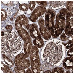C10orf67, Rabbit, Polyclonal Antibody, Abnova 100 &mu;L | Buy Online | Abnova Corporation | Fisher Scientific