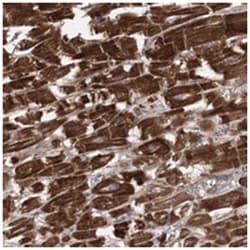 TRIM71 Rabbit anti-Human, Polyclonal Antibody, Abnova 100 &mu;L | Buy Online | Abnova | Fisher Scientific