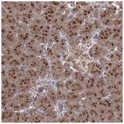 TBC1D23 Rabbit anti-Human, Polyclonal Antibody, Abnova 100 &mu;L | Buy Online | Abnova Corporation | Fisher Scientific