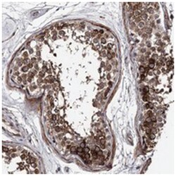 CWF19L2, Rabbit, Polyclonal Antibody, Abnova 100 &mu;L | Buy Online | Abnova | Fisher Scientific
