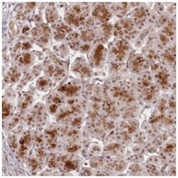FAM204A, Rabbit, Polyclonal Antibody, Abnova 100 &mu;L | Buy Online | Abnova | Fisher Scientific