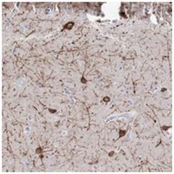 ZNF551, Rabbit, Polyclonal Antibody, Abnova 100 &mu;L | Buy Online | Abnova Corporation | Fisher Scientific