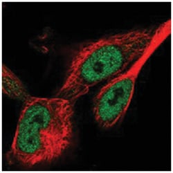 WDR75, Rabbit, Polyclonal Antibody, Abnova 100 &mu;L | Buy Online | Abnova Corporation | Fisher Scientific