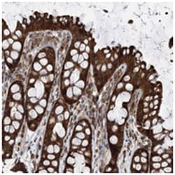 VPS37B, Rabbit, Polyclonal Antibody, Abnova 100 &mu;L | Buy Online | Abnova Corporation | Fisher Scientific