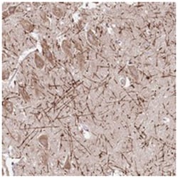 CREG2, Rabbit, Polyclonal Antibody, Abnova 100&mu;L; Unlabeled:Antibodies,