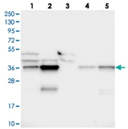 CCDC75, Rabbit, Polyclonal Antibody, Abnova 100 &mu;L | Buy Online | Abnova Corporation | Fisher Scientific