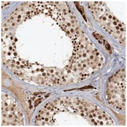 CCDC75, Rabbit, Polyclonal Antibody, Abnova 100 &mu;L | Buy Online | Abnova Corporation | Fisher Scientific
