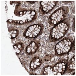 DKFZP564O0823, Rabbit, Polyclonal Antibody, Abnova 100 &mu;L | Buy Online | Abnova Corporation | Fisher Scientific