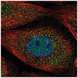 DKFZP564O0823, Rabbit, Polyclonal Antibody, Abnova 100 &mu;L | Buy Online | Abnova Corporation | Fisher Scientific