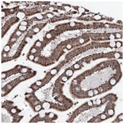 CXorf56 Rabbit anti-Human, Polyclonal Antibody, Abnova 100 &mu;L | Buy Online | Abnova Corporation | Fisher Scientific