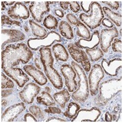 XPO6, Rabbit, Polyclonal Antibody, Abnova 100 &mu;L | Buy Online | Abnova Corporation | Fisher Scientific