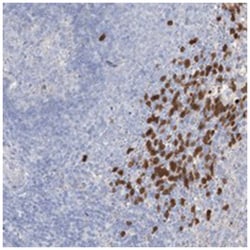 ICHTHYIN, Rabbit, Polyclonal Antibody, Abnova 100 &mu;L | Buy Online | Abnova Corporation | Fisher Scientific