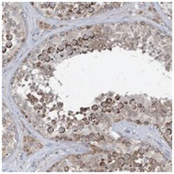 CHCHD5, Rabbit, Polyclonal Antibody, Abnova 100 &mu;L | Buy Online | Abnova Corporation | Fisher Scientific