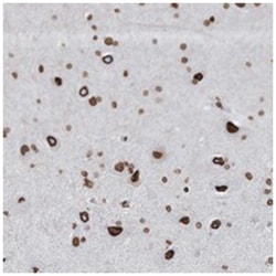 GJD4, Rabbit, Polyclonal Antibody, Abnova 100 &mu;L | Buy Online | Abnova Corporation | Fisher Scientific