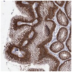 AIRE Rabbit anti-Human, Polyclonal Antibody, Abnova 100 &mu;L | Buy Online | Abnova Corporation | Fisher Scientific