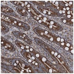 UCN3, Rabbit, Polyclonal Antibody, Abnova 100 &mu;L | Buy Online | Abnova Corporation | Fisher Scientific