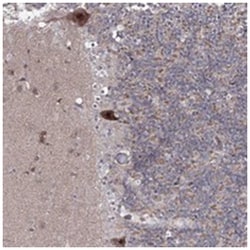 HOXC11, Rabbit, Polyclonal Antibody, Abnova 100&mu;L; Unlabeled:Antibodies,