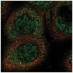 HOXC11, Rabbit, Polyclonal Antibody, Abnova 100&mu;L; Unlabeled:Antibodies,