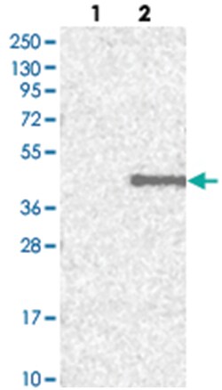 HOXC11, Rabbit, Polyclonal Antibody, Abnova 100&mu;L; Unlabeled:Antibodies,