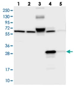 ECHDC3, Rabbit, Polyclonal Antibody, Abnova 100 &mu;L | Buy Online | Abnova Corporation | Fisher Scientific
