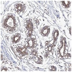 ECHDC3, Rabbit, Polyclonal Antibody, Abnova 100 &mu;L | Buy Online | Abnova Corporation | Fisher Scientific