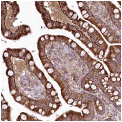 PYROXD1, Rabbit, Polyclonal Antibody, Abnova 100 &mu;L | Buy Online | Abnova Corporation | Fisher Scientific