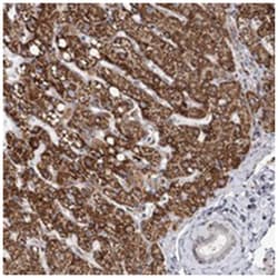 ZCCHC24, Rabbit, Polyclonal Antibody, Abnova 100 &mu;L | Buy Online | Abnova Corporation | Fisher Scientific