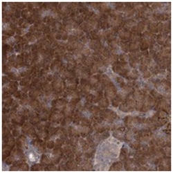 TBC1D9B, Rabbit, Polyclonal Antibody, Abnova 100&mu;L; Unlabeled:Antibodies,