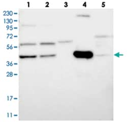 NADKD1, Rabbit, Polyclonal Antibody, Abnova 100 &mu;L | Buy Online | Abnova Corporation | Fisher Scientific