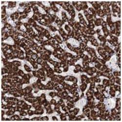 NADKD1, Rabbit, Polyclonal Antibody, Abnova 100 &mu;L | Buy Online | Abnova Corporation | Fisher Scientific