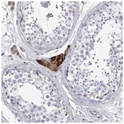 SYNGAP1, Rabbit, Polyclonal Antibody, Abnova 100 &mu;L | Buy Online | Abnova Corporation | Fisher Scientific