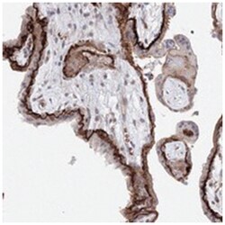 C11orf52, Rabbit, Polyclonal Antibody, Abnova 100 &mu;L | Buy Online | Abnova Corporation | Fisher Scientific