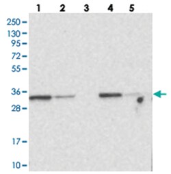 MTCH2 Rabbit anti-Human, Polyclonal Antibody, Abnova 100 &mu;L | Buy Online | Abnova Corporation | Fisher Scientific