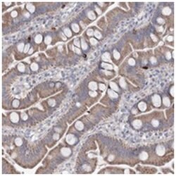 MTCH2 Rabbit anti-Human, Polyclonal Antibody, Abnova 100 &mu;L | Buy Online | Abnova Corporation | Fisher Scientific
