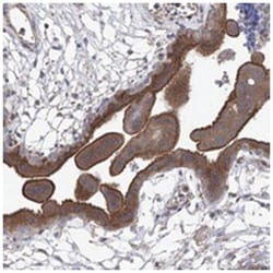 CPEB4 Rabbit anti-Human, Polyclonal Antibody, Abnova 100 &mu;L | Buy Online | Abnova | Fisher Scientific