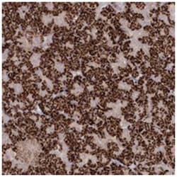 TGFBRAP1, Rabbit, Polyclonal Antibody, Abnova 100&mu;L; Unlabeled:Antibodies,