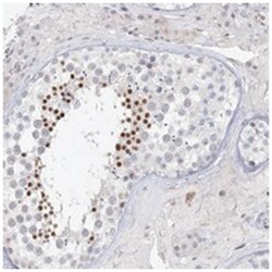 C6orf222, Rabbit, Polyclonal Antibody, Abnova 100 &mu;L | Buy Online | Abnova Corporation | Fisher Scientific