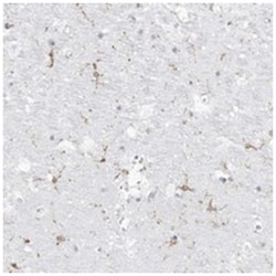 C11orf1, Rabbit, Polyclonal Antibody, Abnova 100 &mu;L | Buy Online | Abnova Corporation | Fisher Scientific