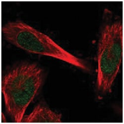 C11orf1, Rabbit, Polyclonal Antibody, Abnova 100 &mu;L | Buy Online | Abnova Corporation | Fisher Scientific
