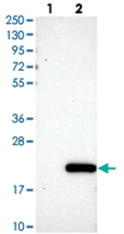 C11orf1, Rabbit, Polyclonal Antibody, Abnova 100 &mu;L | Buy Online | Abnova Corporation | Fisher Scientific