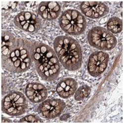 WDR48, Rabbit, Polyclonal Antibody, Abnova 100&mu;L; Unlabeled:Antibodies,