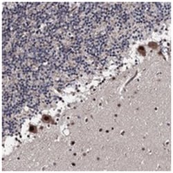 PRPF40B Rabbit anti-Human, Polyclonal Antibody, Abnova 100 &mu;L | Buy Online | Abnova Corporation | Fisher Scientific