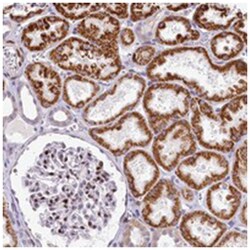 HISPPD1, Rabbit, Polyclonal Antibody, Abnova 100 &mu;L | Buy Online | Abnova Corporation | Fisher Scientific