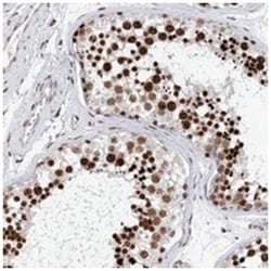 FRMD4A, Rabbit, Polyclonal Antibody, Abnova 100&mu;L; Unlabeled:Antibodies,