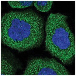 BFSP2, Rabbit, Polyclonal Antibody, Abnova 100&mu;L; Unlabeled:Antibodies,