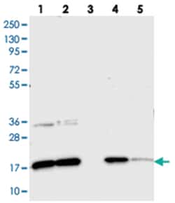 CNPY2 Rabbit anti-Human, Polyclonal Antibody, Abnova 100&mu;L; Unlabeled:Antibodies,