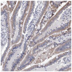 PPRC1, Rabbit, Polyclonal Antibody, Abnova 100 &mu;L | Buy Online | Abnova Corporation | Fisher Scientific