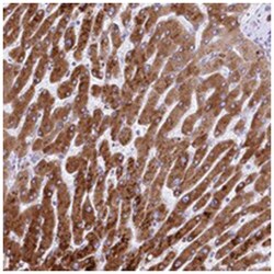 RDH16, Rabbit, Polyclonal Antibody, Abnova 100 &mu;L | Buy Online | Abnova Corporation | Fisher Scientific